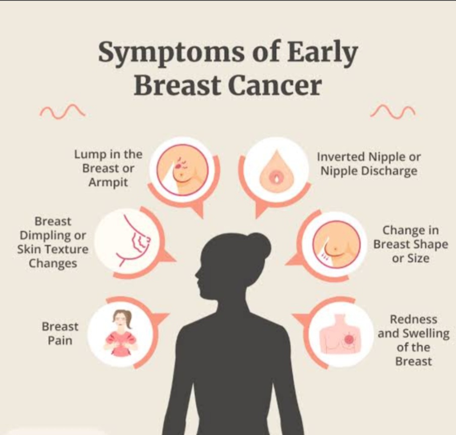 Breast Cancer: Overview of Signs, Symptoms and Stages.