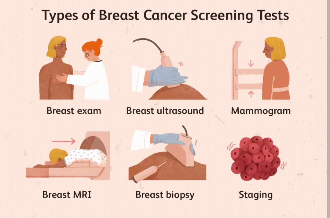 Breast :Causes, Diagnosis and Tests.