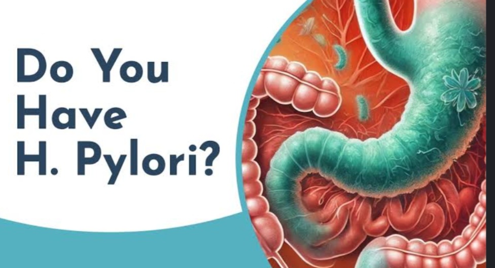 Helicobacter pylori (H.pylori): Management